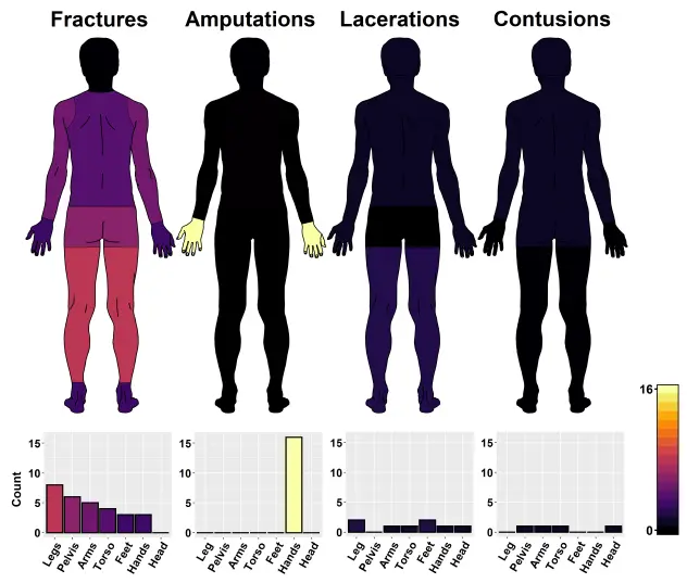 Anatomical distribution of the four injury types that accounted for 80% of reported injuries documented in the Robot-Related Injuries in the Workplace projects.